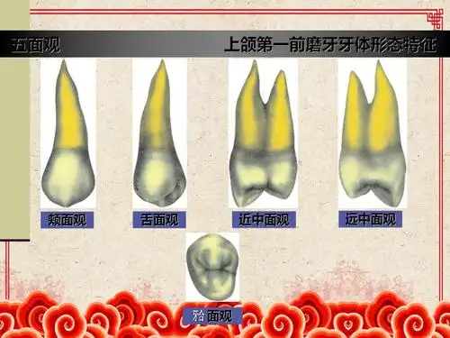 上颌第一前磨牙牙体形态简述