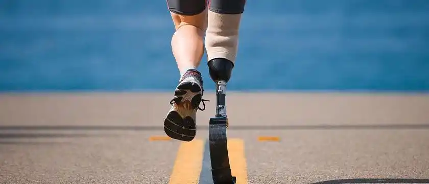 碳纤维复合材料在医用假肢方面的使用