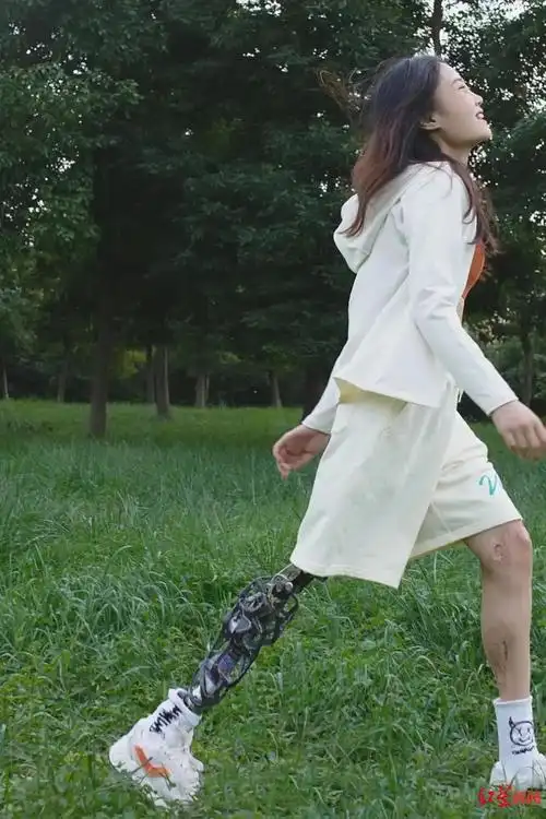 钢腿女孩成为四川省人大代表