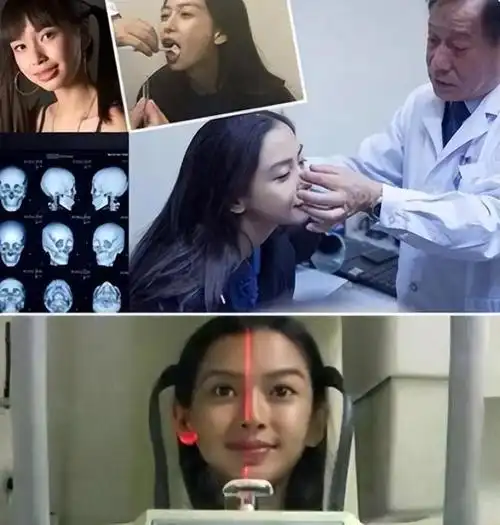 回顾:长得"歪瓜裂枣",整得"美若天仙",6位女星靠脸改命!