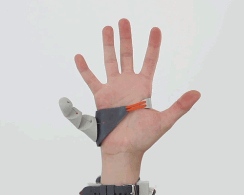 你的第六根手指居然长这样可3d打印的智能假肢