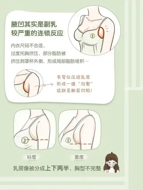 有没有觉得自己胸型不好看,看起来不成形71如果有请对镜自查,94