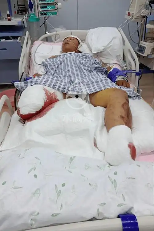 遭遇惨烈车祸已截肢,刘官营11岁男孩急需帮助!_刘佳旺_孩子_治疗