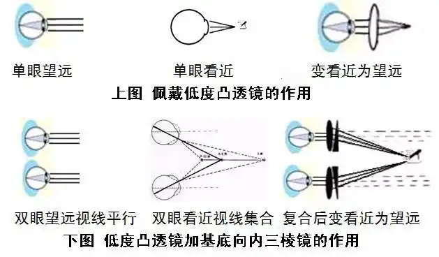 低度凸透镜加基底向内三棱镜