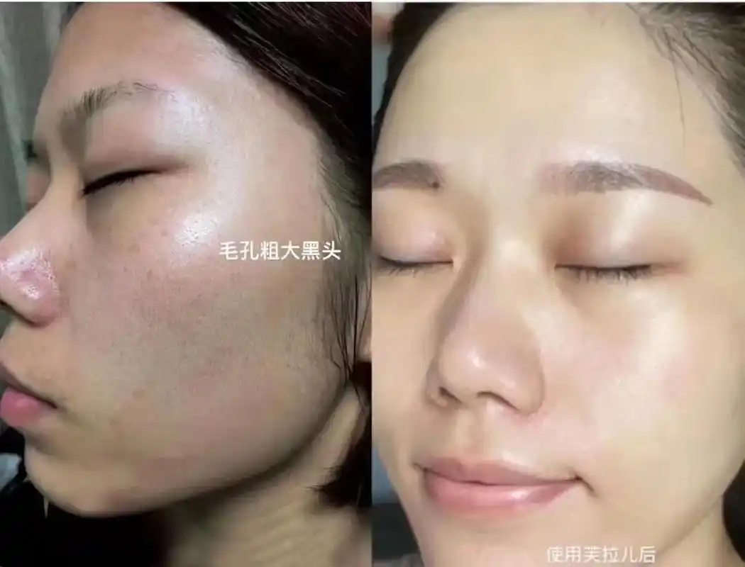 96皮肤问题困扰6315.