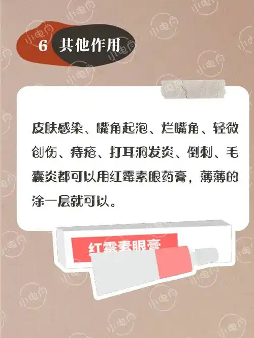 红霉素眼膏的宝藏用法你知道么存起来