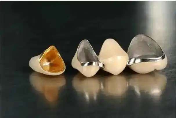 「保姆级攻略」想做种植牙:一篇文章教你找到最靠谱的种植方案!