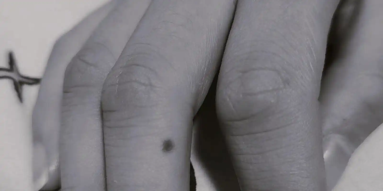 中指的痣到底代表什么呢? 谁能告诉我这是什么意思