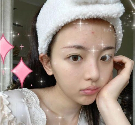 杨超越分享近况,罕见素颜出镜,额头长痘丝毫没有偶像包袱