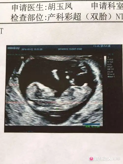 nt看男女,准确吗?