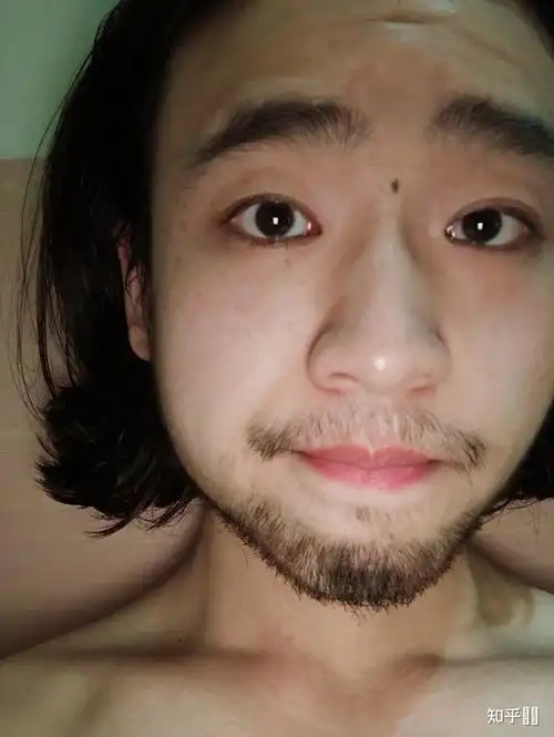 一个男生长美人痣是种什么样的体验?