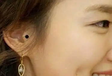 解析耳朵长痣位置与命运