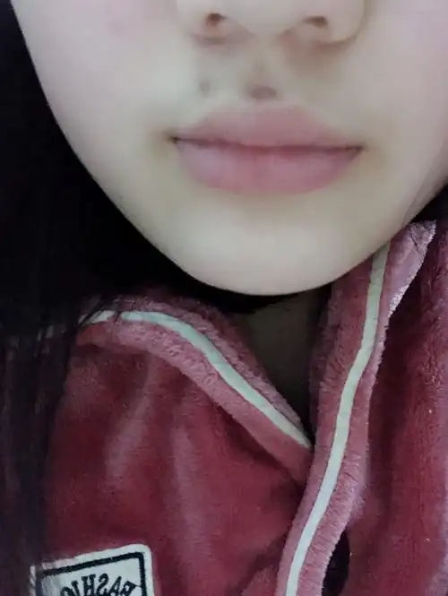 我的嘴唇左上方有个痣,不知道好不好