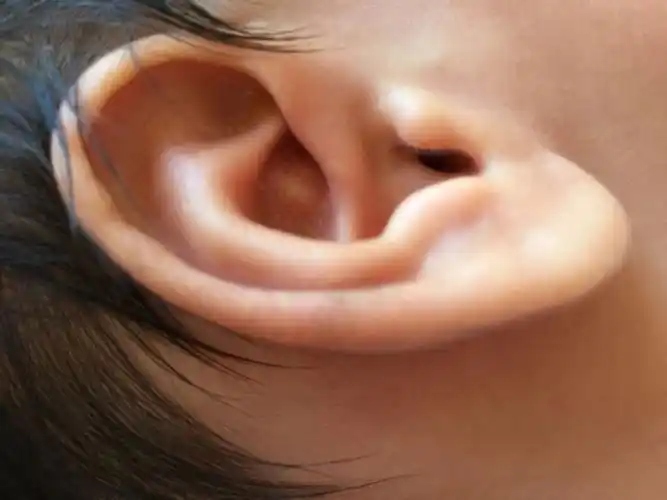 今天发现宝宝耳廓上起了个白色的包,不知道是什么,害怕是中耳炎,请问