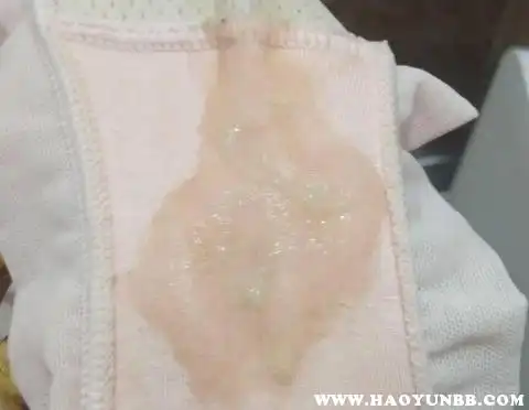 在孕早期,内裤上总是湿的,感觉像尿,这是因为怀孕期间雌孕激素水平