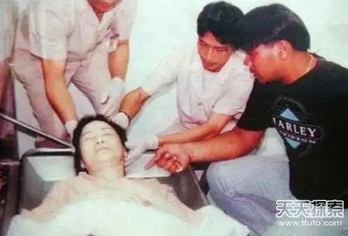邓丽君死亡后,尸体左脸颊上竟遗有一个巴掌红印