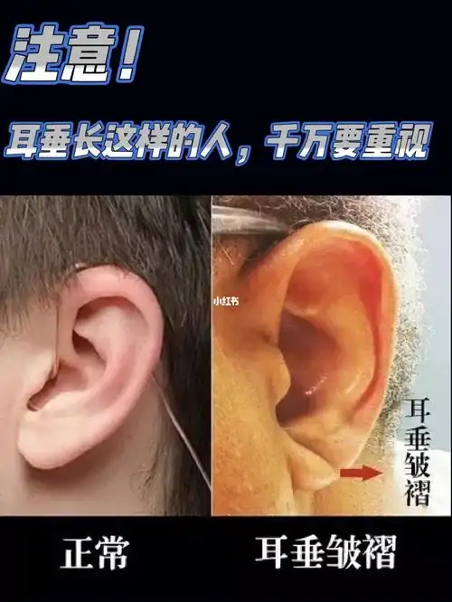 注意75耳垂长这样的人,千万要重视6015