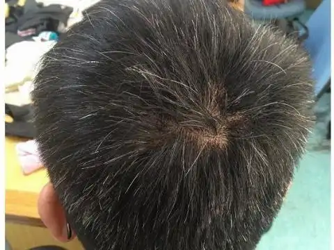 梦见长了几根白头发