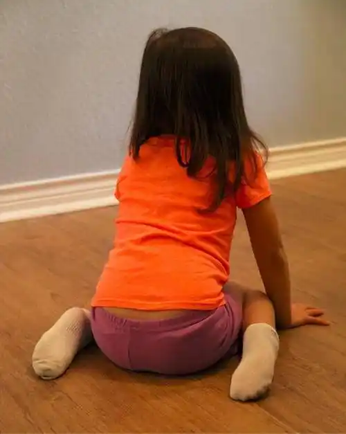 孩子喜欢w坐会变成o型腿吗