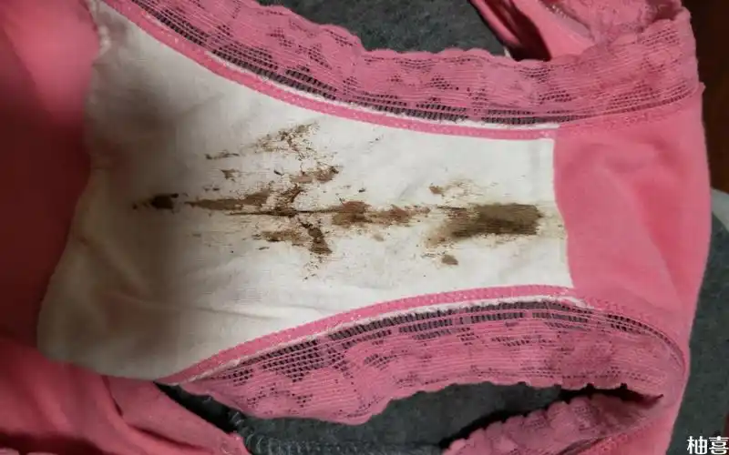 怀孕40天后流褐色颜色的血是好事还是坏事