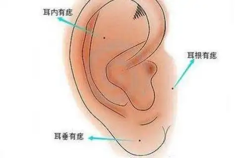 女人耳朵长痣好不好命运怎么样