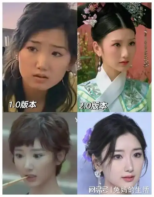 鼻子大变样疑似整容,医美痕迹太重引热议|毛晓彤|娱乐圈|亿身家_网易