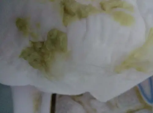 我排卵期 怎么排出来这种东西,像豆腐渣又不像有点黄色又有点绿色的