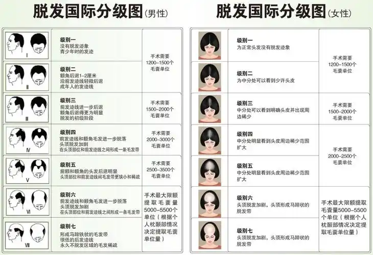 请问这是什么类型的脱发,能治好吗?怎么治.