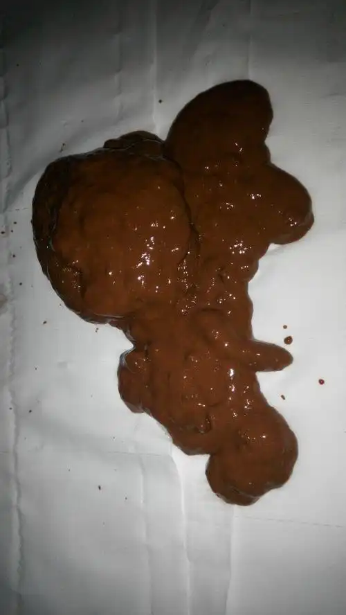 胃刺痛,胃燃烧,口渴,头晕晕,大便呈棕色,咖啡色或再暗一点的颜色,如果