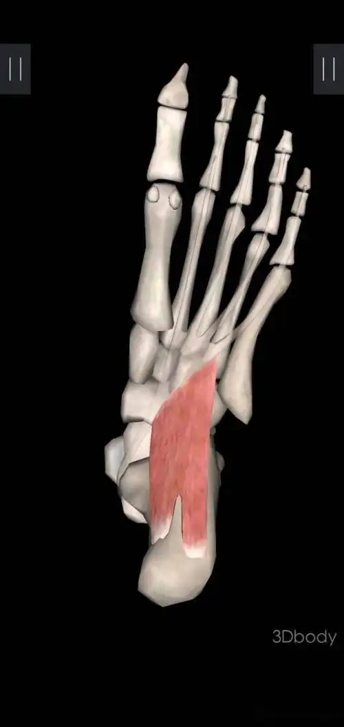 足底方肌触发点会引起足跟刺痛,这种疼痛像脚趾踩到石头上被擦伤的