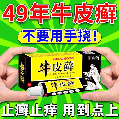 牛皮癣药膏顽固性牛皮癣手足癣银屑病湿疹皮肤病鳞屑点状出血止痒