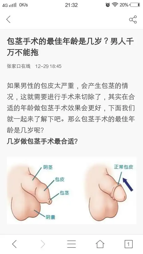 绣式包皮环切彻底打破男人对传统手术的恐念!