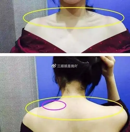 斜方肌瘦了,就可以显瘦20斤?