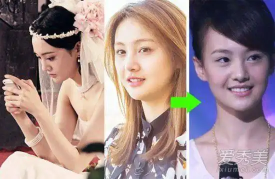 《偏偏喜欢你》郑爽整容后越来越红 脸型怪异显老气(组图)