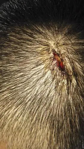 今天打篮球抢篮板的时候头撞到别人的牙齿了.当时就搽了碘酒.伤口没