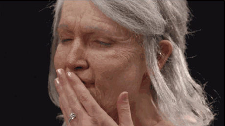 【常德德美】玻尿酸怎么选,选哪种?你都知道吗?