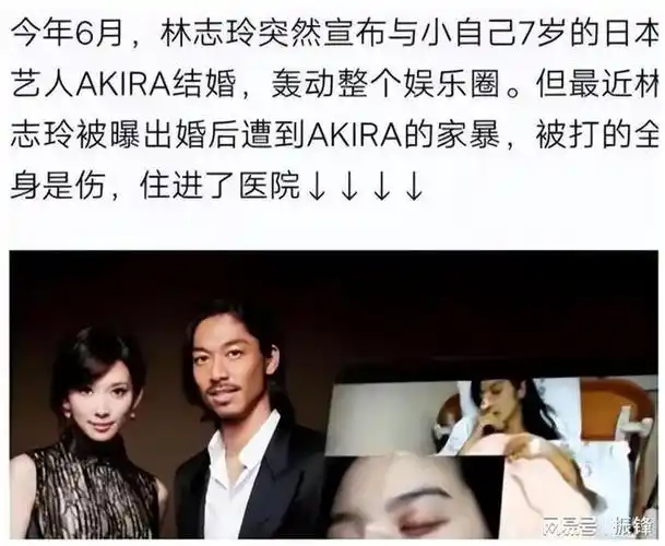 甚至,还晒出了疑似林志玲被打进医院的照片.