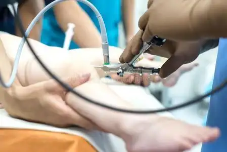 膀胱镜检查一队关于泌尿科医师医生表演的一膀胱镜检查使用一囊肿照片