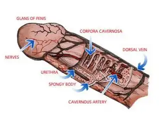 临床表现为阴囊的一侧或两侧肿大如水晶,不红不热,下控睾丸,上引小腹