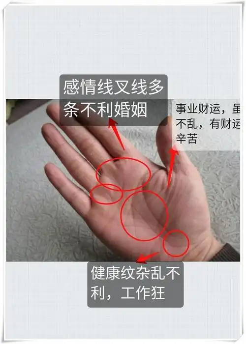 手相长痣聚财手一马平川富贵手相