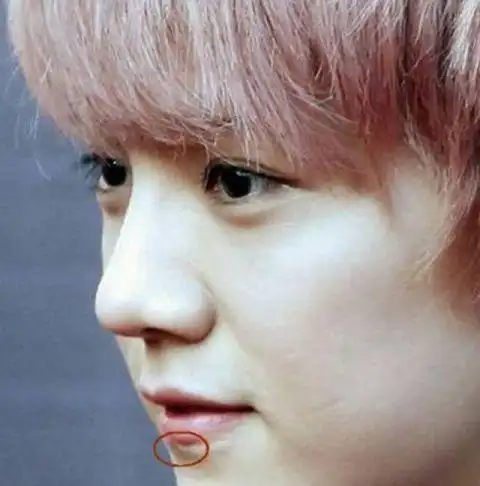 娱乐圈5大明星脸上的伤疤,杨幂的很是奇葩,最后一位的很严重!