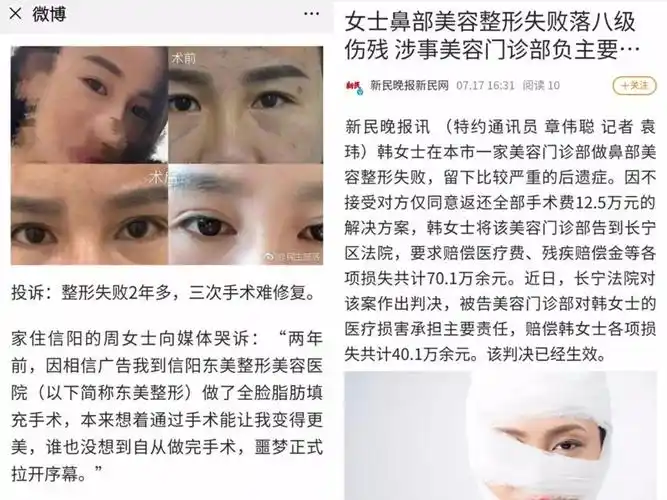 微博截图-整形失败案例