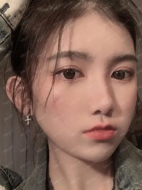 全切双眼皮90天啦 这样护理恢复超自然 我的眼睛是_圈子-新氧美容整形