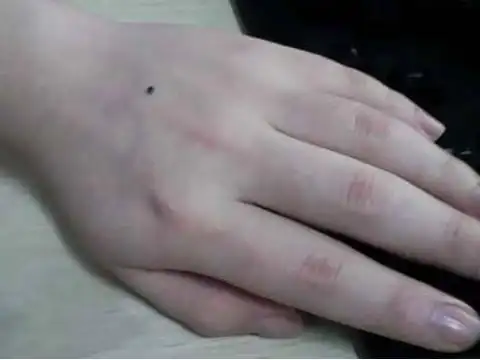 女人左手背有痣命运