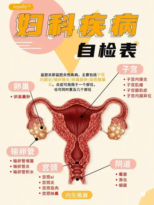 妇科疾病的表现别不当回事