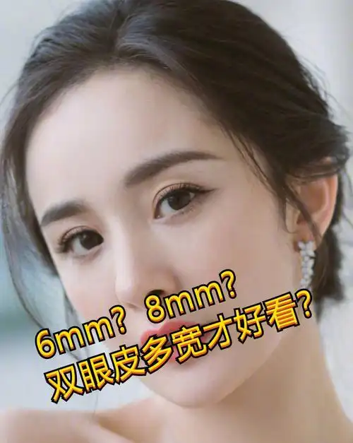 68mm双眼皮多宽看杨幂景田戚薇热巴