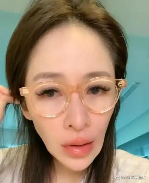 萧亚轩失恋生病!倒三角脸嘴歪,头发凌乱眼迷离,被劝看心理医生