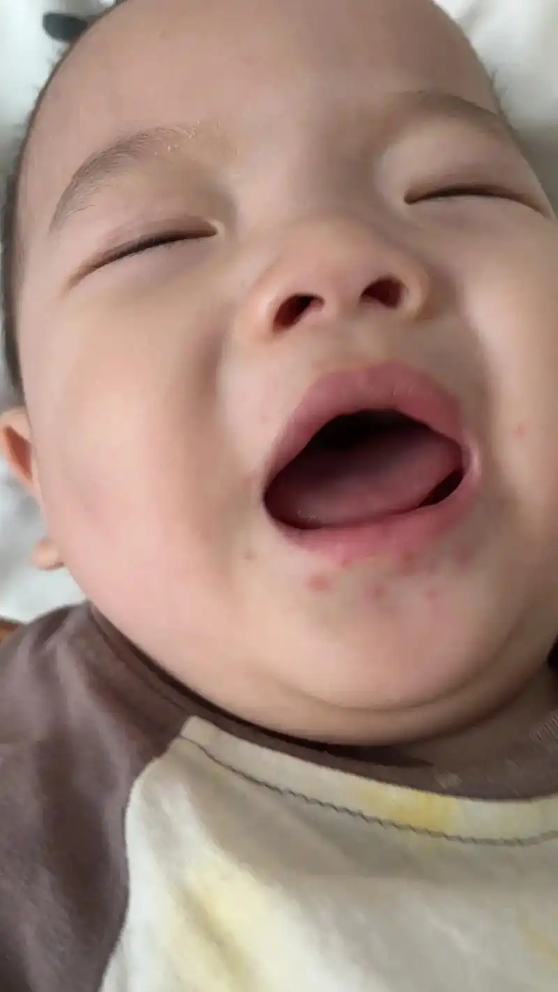 跟大家分享一下七个多月宝宝感染上手足口的过程.平时 - 抖音