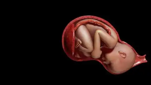 胎儿_妈妈_子宫