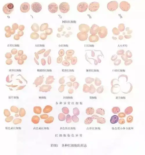 科学告诉你:如何从血液红细胞的形状看身体健康